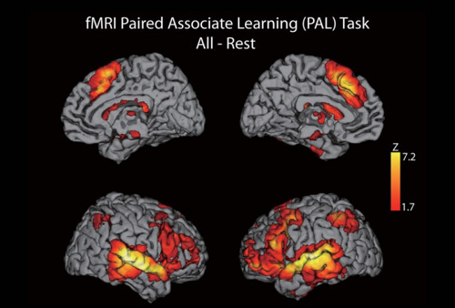 任务态功能磁共振(task-fMRI)数据处理